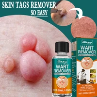 skin tags warts removal serum painless mole dark spot remover treatment papillomas flat wart genitals skin labels essential oil