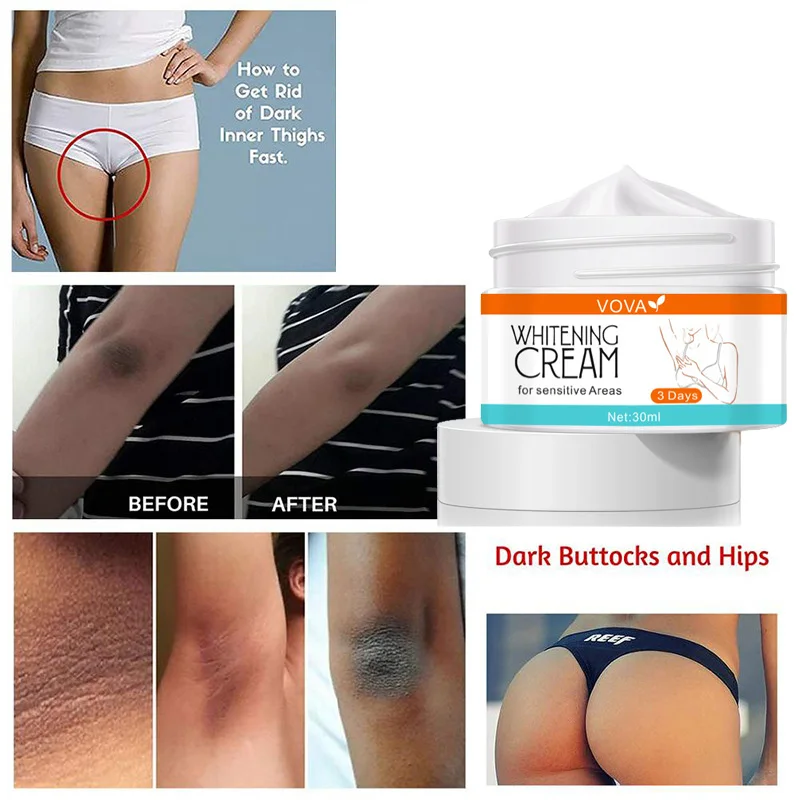 

Body Whitening Cream Private Parts Skin Brightening Underarm Bleaching Remove Melanin Pigmentation Improve Dullness Skin Care