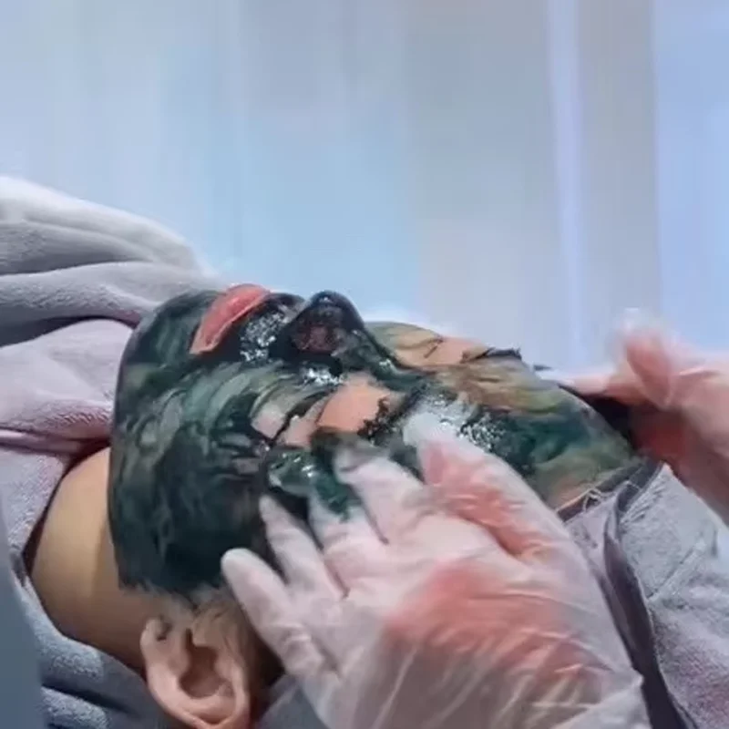 Силиконовая игла с морскими водорослями растительная губка прыщи яма ремонт