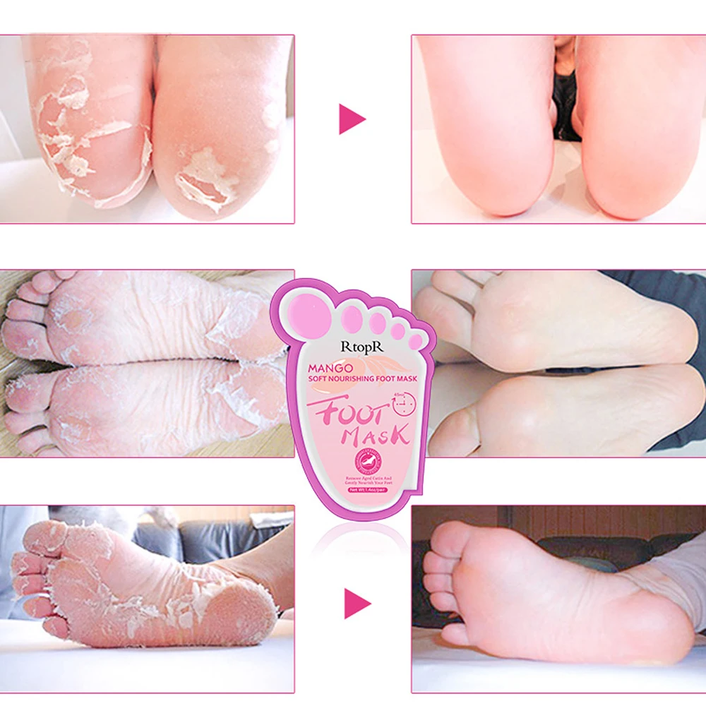 Мягкая питательная маска для ног манго увлажняющая антисухая удаляет