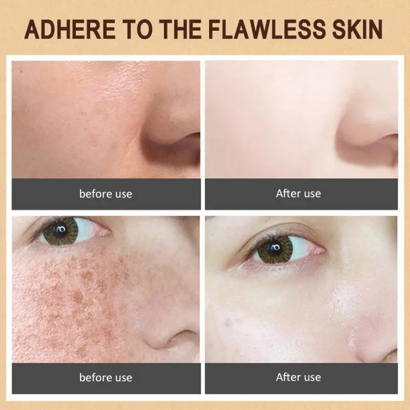 Сильные эффекты мощный дневной свет желтые пятсветильник крем от акне уход за