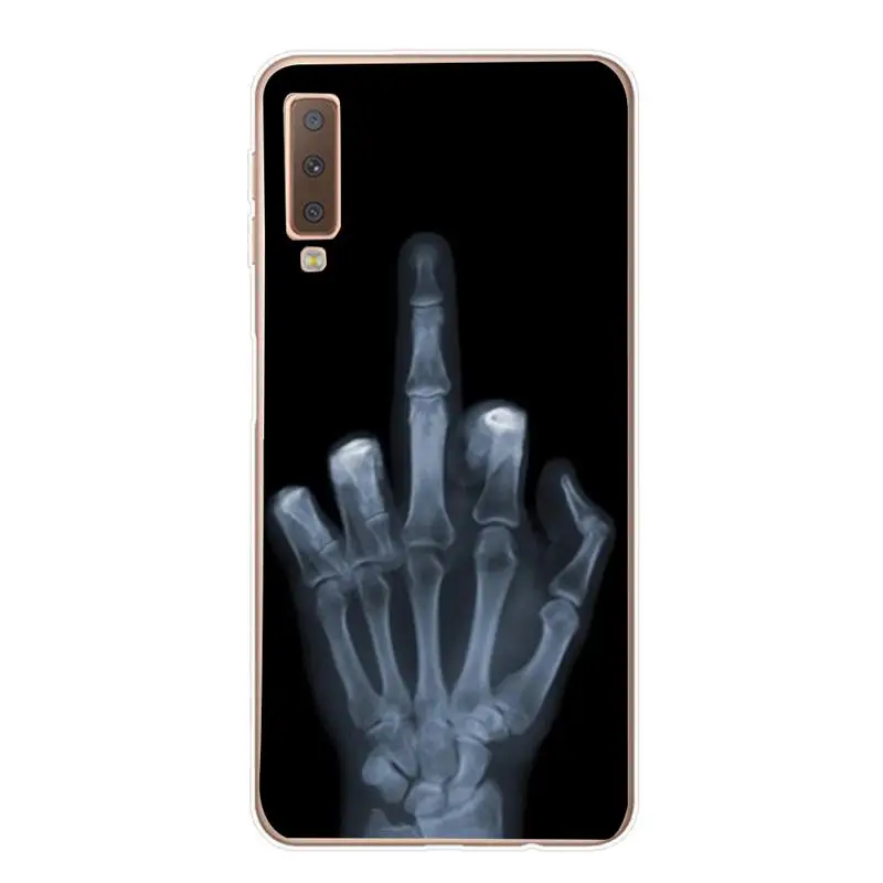 Цвет: желтый Цветок чехол для samsung A7 J5 Мягкий силиконовый чехол для телефона для samsung Galaxy Note 9 S8 S9 A8 плюс S7 край A7 Fundas - Цвет: Цвет: желтый