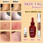 Быстрое Удаление родинок, Быстрое Удаление родинок и генитальных бородавок, набор для лечения мозолей на ногах, восстановление натуральной бактериостатической жидкости