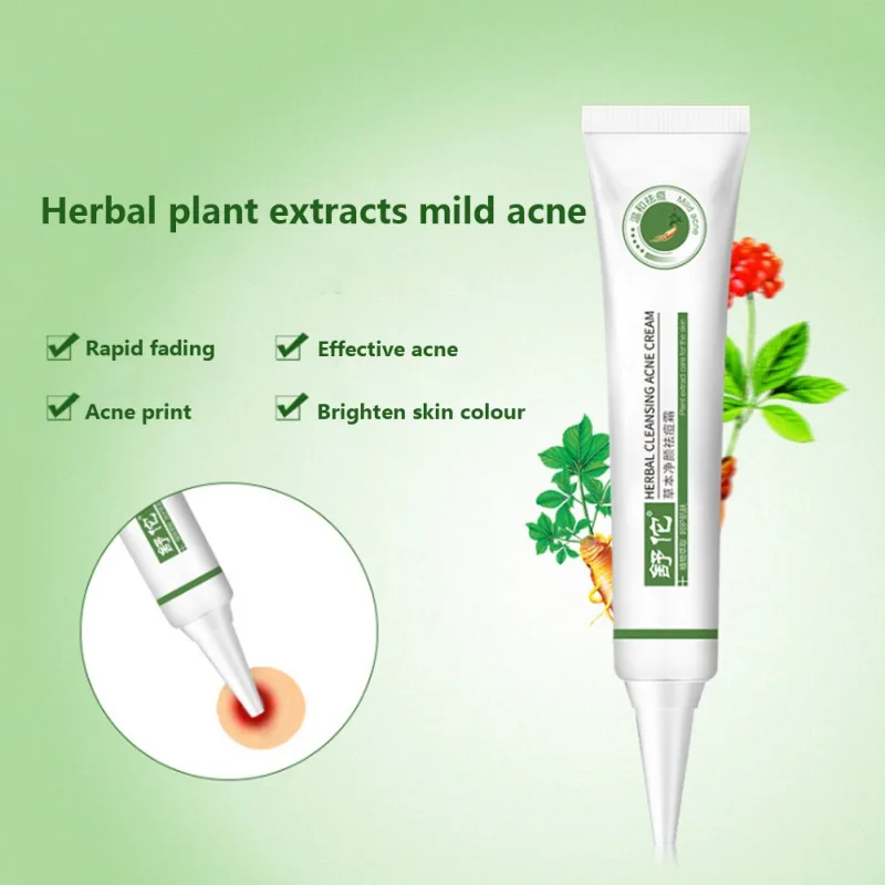 

Moisturizing Shrinking Pores Anti-acne Cream Lighten Skin Color Hot Sale Acne Marks Pimple Removal Cream