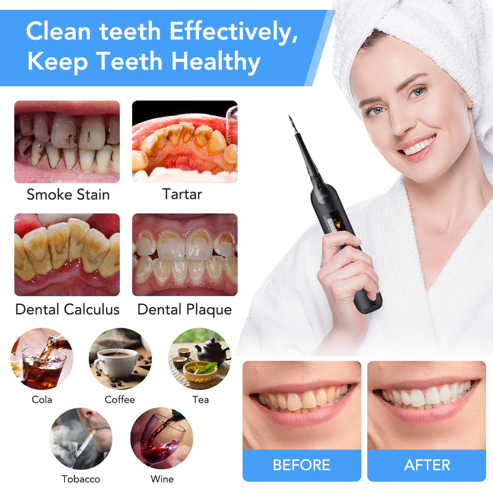 

Electric Sonic Dental Scaler LED Display Tooth Calculus Remover Stain Removal Tartar Ultrasonic Tooth Cleaner Teeth Whitening
