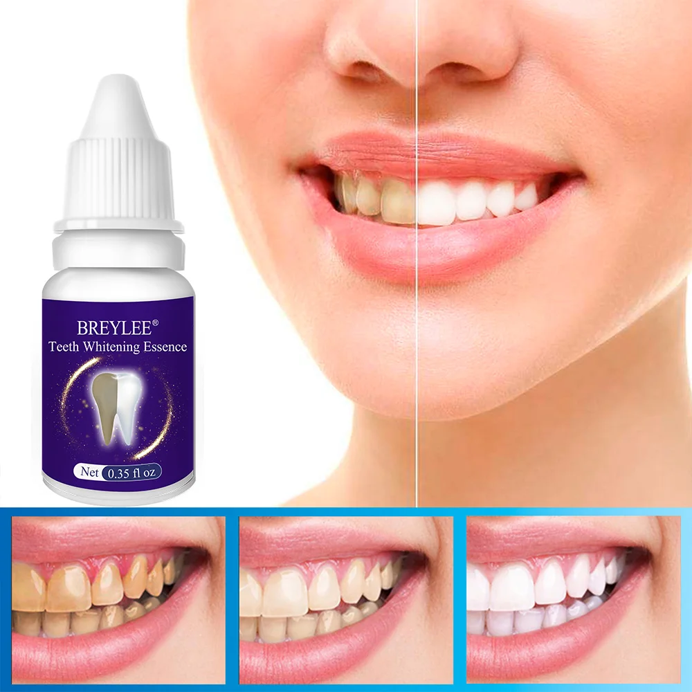 

Эссенция для отбеливания зубов BREYLEE, зубная паста, стоматологические инструменты, чистящая белые зубы, бриллиантовая сыворотка, удаление пя...