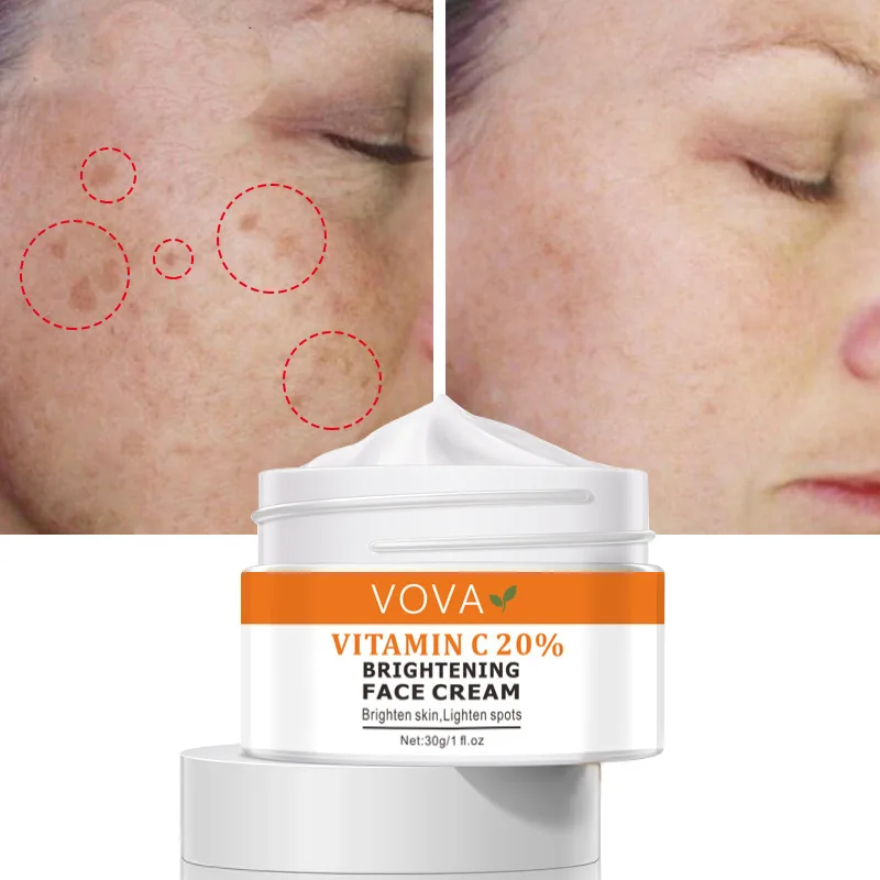 

VOVA Vitamin C 20% Face Cream Remove Dark Spots Facial Whitening Gel Repair Fade Freckls Melanin Remover Brighten Skin Care 30ml