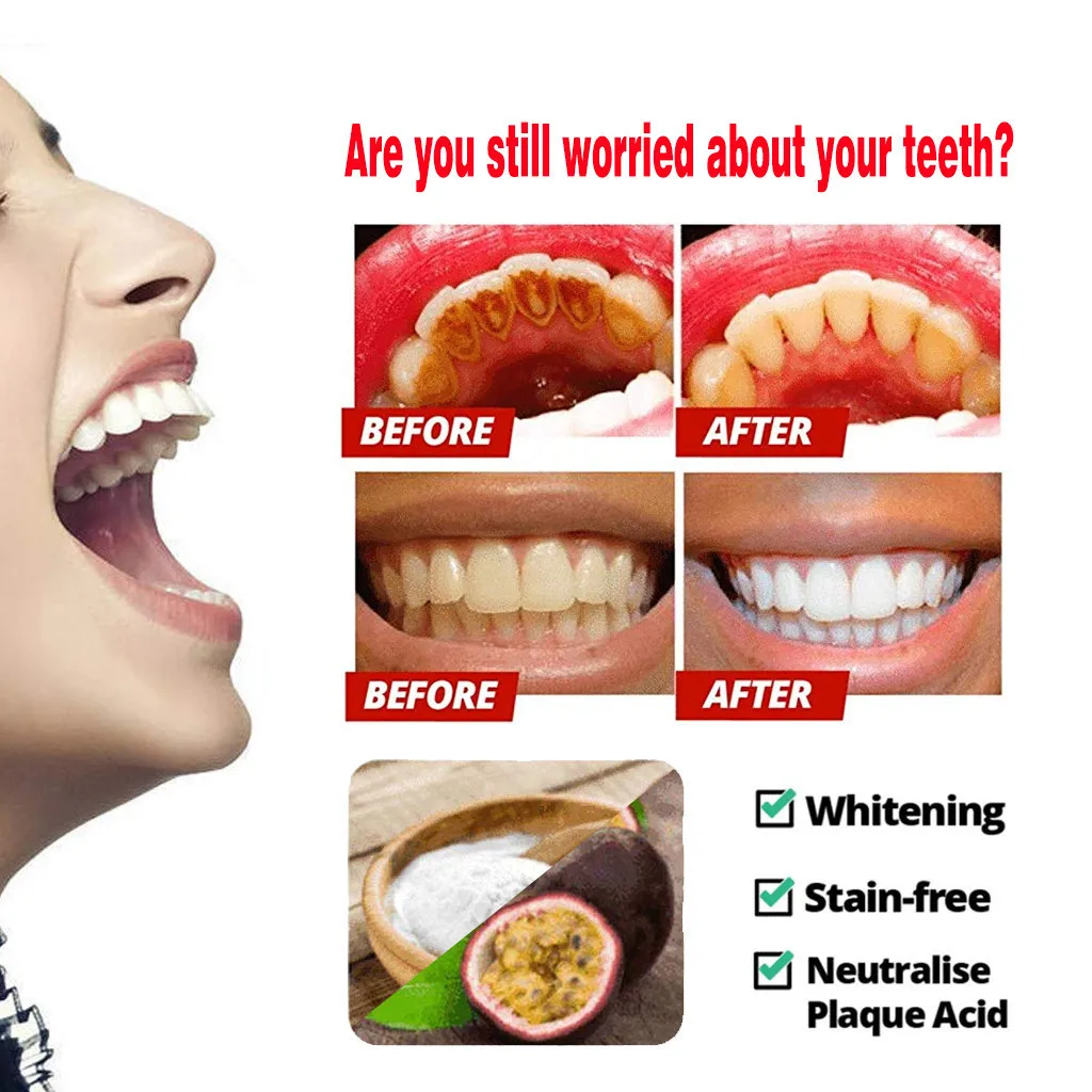 

Stain Removal Whitening Toothpaste Fight Bleeding Gums Toothpaste