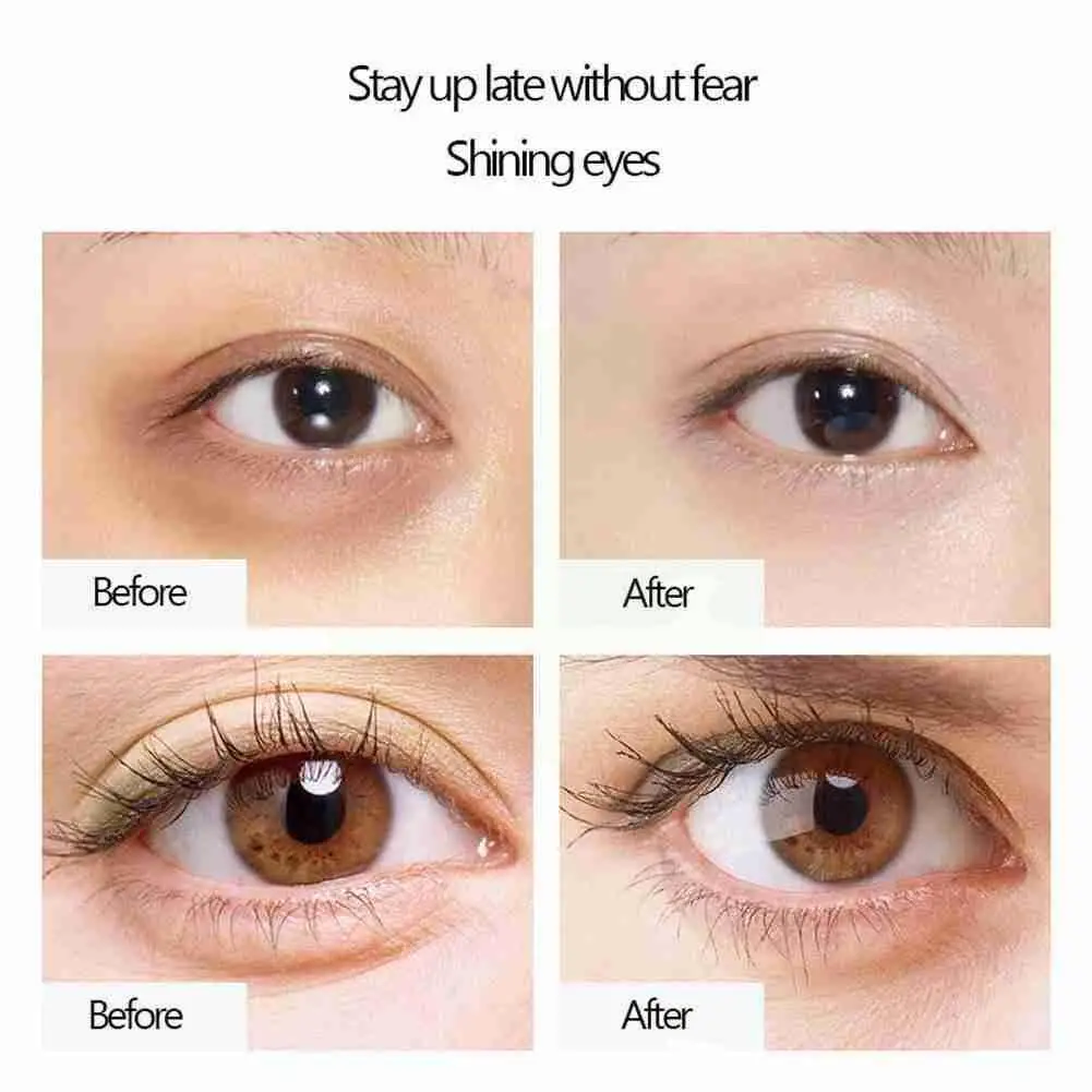 

Eye Cream Massage Stick Circles Remover Eliminate Eye Anti-wrinkles Ball Tightening Eye Roller Massager Bags Lifting Tools B8K5