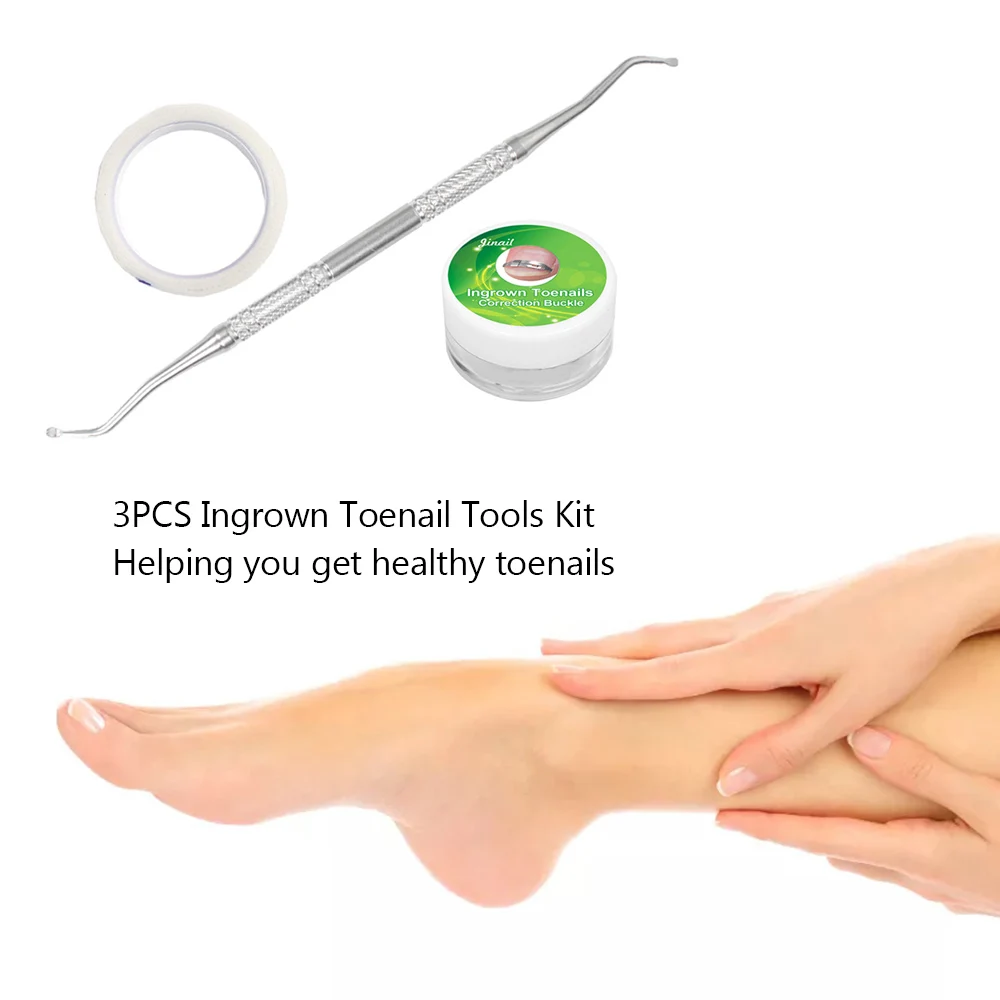 3 шт. инструменты для вросших ногтей лечения Ногтей инструмент удаления
