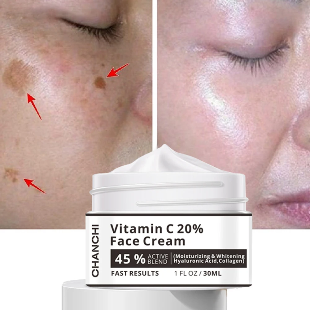 

Effective Whitening Freckle Cream Rich in Vitamin C 20% for Removing Melasma Acne Dark Spots Pigmentation Moisturizing Gel