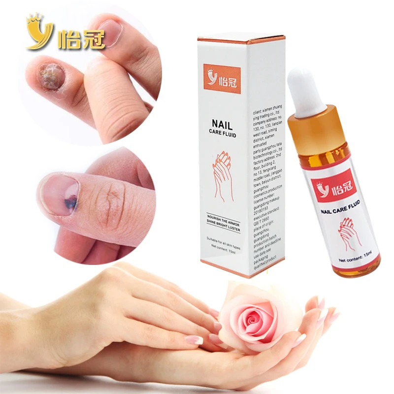 

Nail Repair Essence Serum Fungal Nail Treatment Remove Onychomycosis Hands and Feet Care of Toe Nail Nourishing Brighte