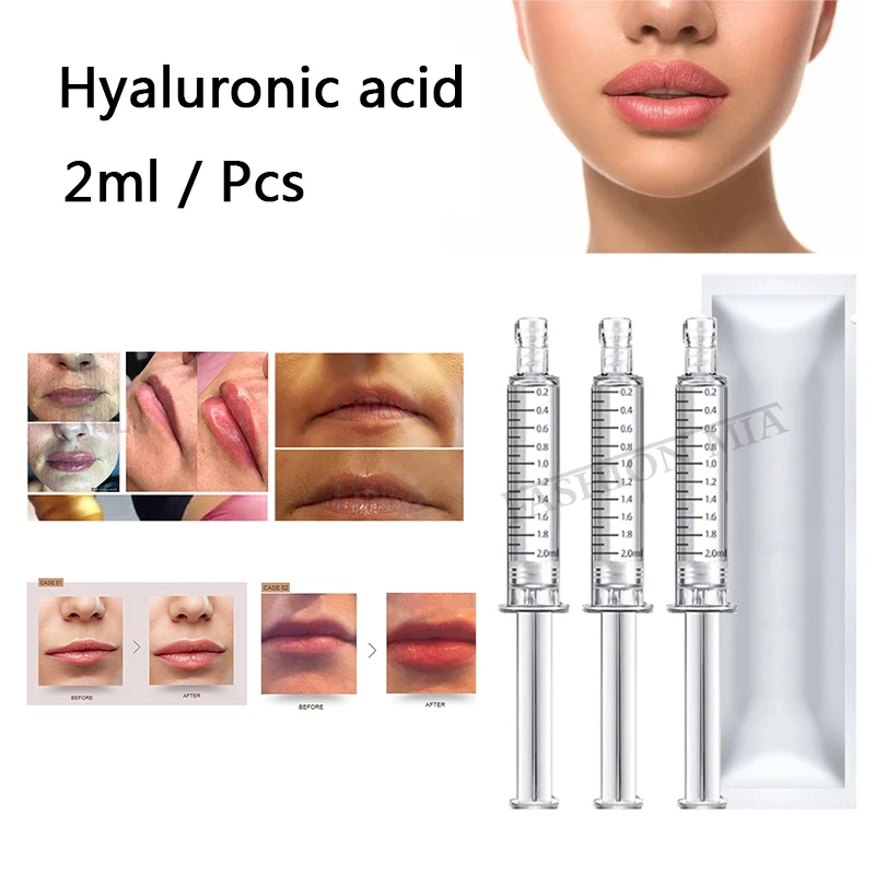 

2ml/5ml/10ml Lip Filler Injections Cross-linked Enlarged Lip Lifting Injector Hyaluronic Acid Lip Filling For Hylauron Acid Pen