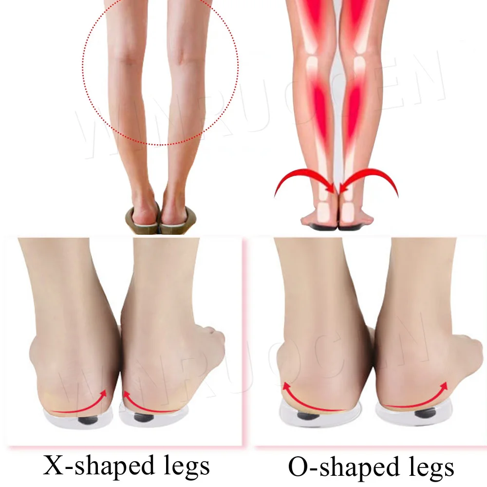 Магнитные массажные стельки ортопедические для ног типа O/X корректирующие