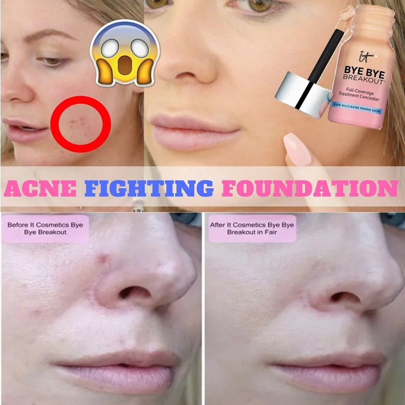 

Face makeup liquid concealer IT bye bye breakout full coverage treatment concealer 10.5ml Waterproof Cream