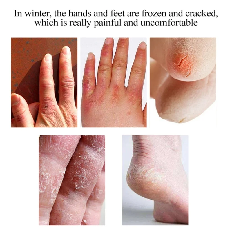 Конский масляный крем от трещин пятки для рук пилинг стопы ремонт анти сухой мазь