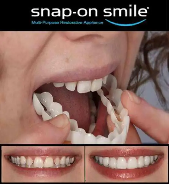 

Cosmetic Dentistry Snap On Smile Instant Smile Comfort Fit Flex Cosmetic Teeth One Size Fits Most Comfortable Denture Care