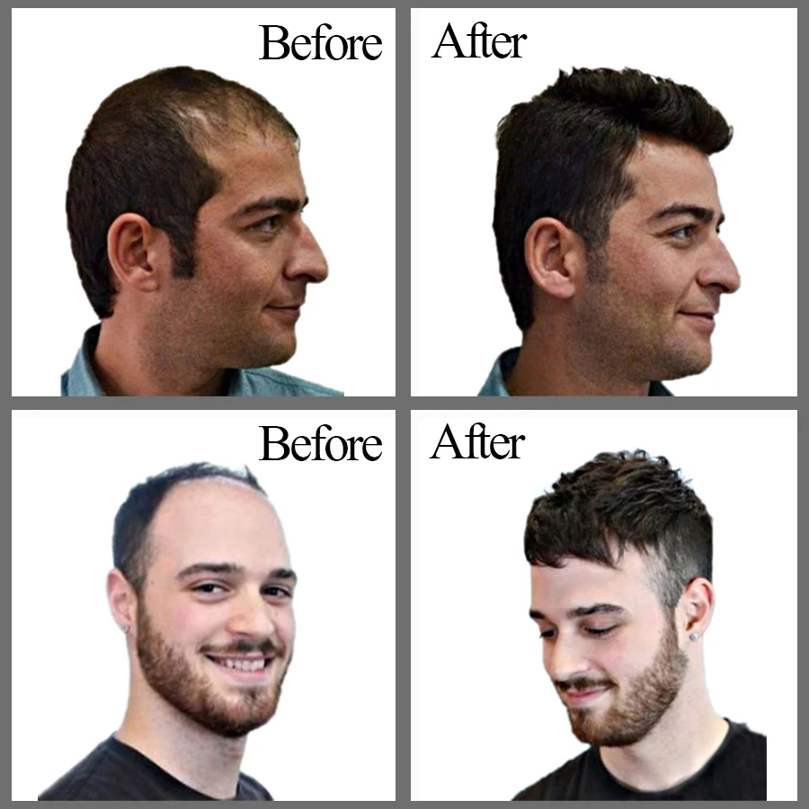 Alileader Высокое качество Мужские волосы Toupees 18 см x 20 натуральный цвет человеческие
