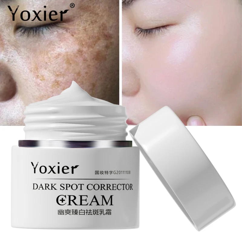 

Dark Spot Corrector Cream Remove Spots Body Pigmentation Face Cream Nourish Arbutin Whiten And Brighten Complexion Skin Care 30g