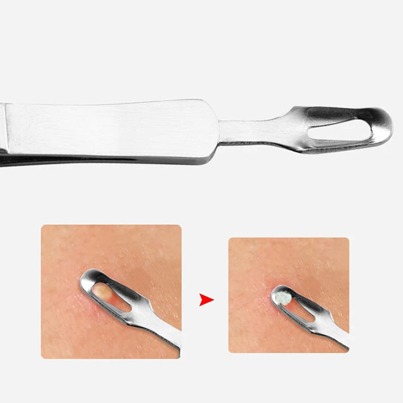 1PC Curved Straight Blackhead Tweezers Double Head Acne Anti Slip Stainless Steel Needle Removal Tool |