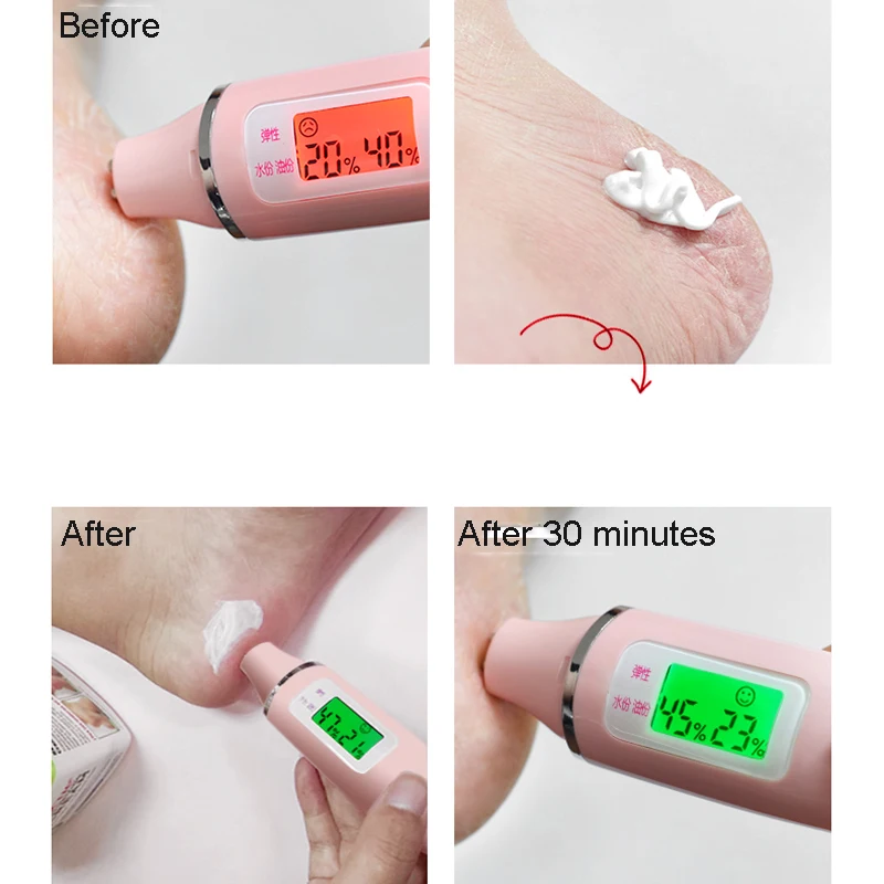 

Traditional Chinese Oil Anti-Drying Crack Foot Cream Heel Cracked Repair Cream Removal Dead Skin Hand Feet Care Foot Spa 33g