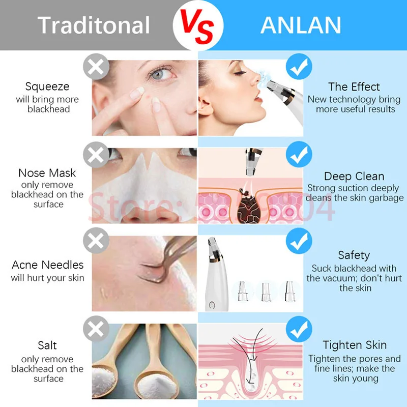 Электрическая машина для удаления угрей уход за кожей лица акне Вакуумная