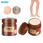 1 шт. 20g крем против варикозного расширения вен бедра флебит васкулита лечение мазь паук удалить анти-отекают облегчение боли медицинский пластырь