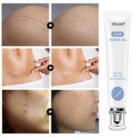 acne cream treatment pigmentation corrector whitening skin repair care scar removal gel removal strectch mark scar body cream