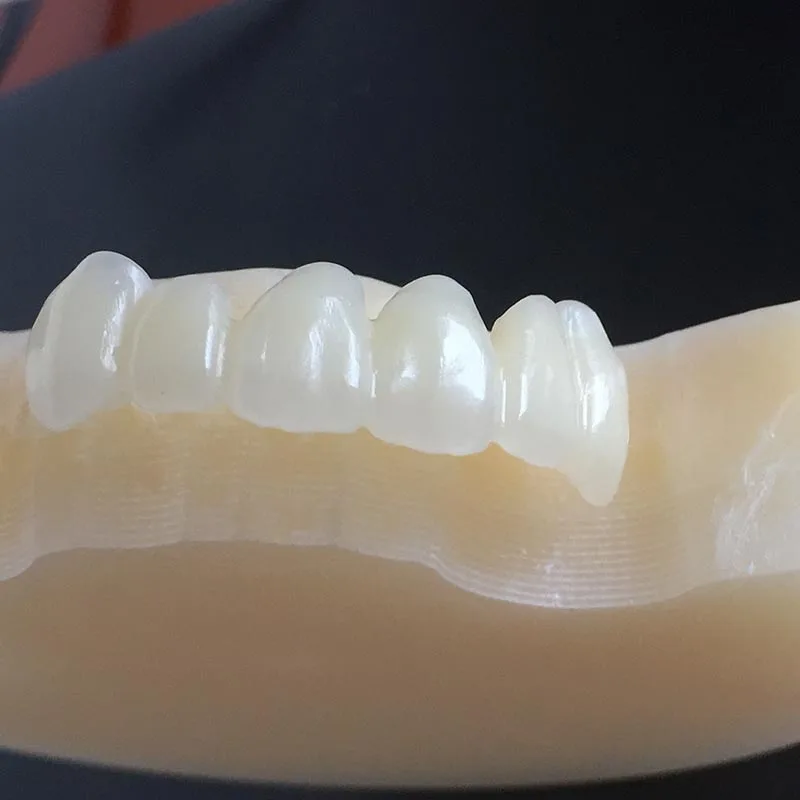 

95*25mm Dental Multilayer PMMA Disc for Temporary Denture Crown Wieland CAD CAM System C1/C2/C3/C4/D2/D3/D4