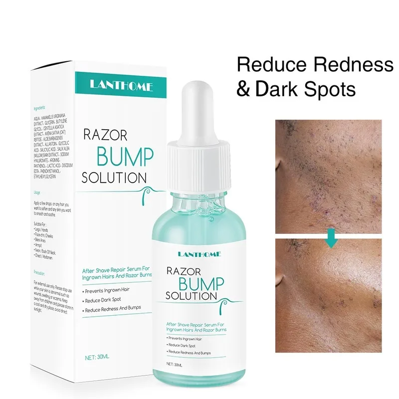 

LANTHOME 30ml Repair Serum After Hair Removal Prevent Ingrown Hairs and Razor Bump Body Treatment Smooth Skin Reduce Dark Spots