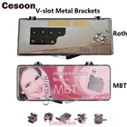 Стоматологические Ортодонтические V-образные металлические скобы 20 шт.кор., скобы, вертикальные скобы, мини-скобыMBT 0,022, 345 крючков, стоматологические материалы