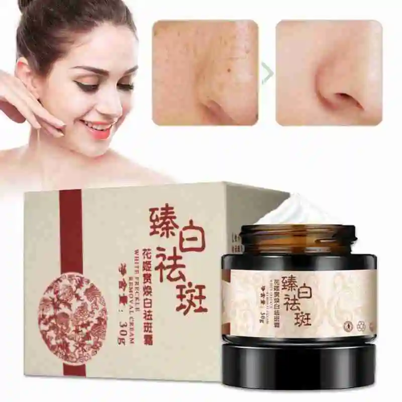 

Whitening Freckle Removal Cream Brightening Skin Age Spots Skin Whitening Dark Strong Effect Cream R7A6