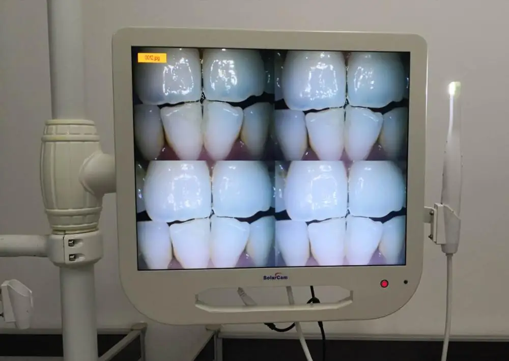 17 &quotIntraoral Camera светодиодный белый монитор с VGA соединением 16 Гб памяти | Красота и