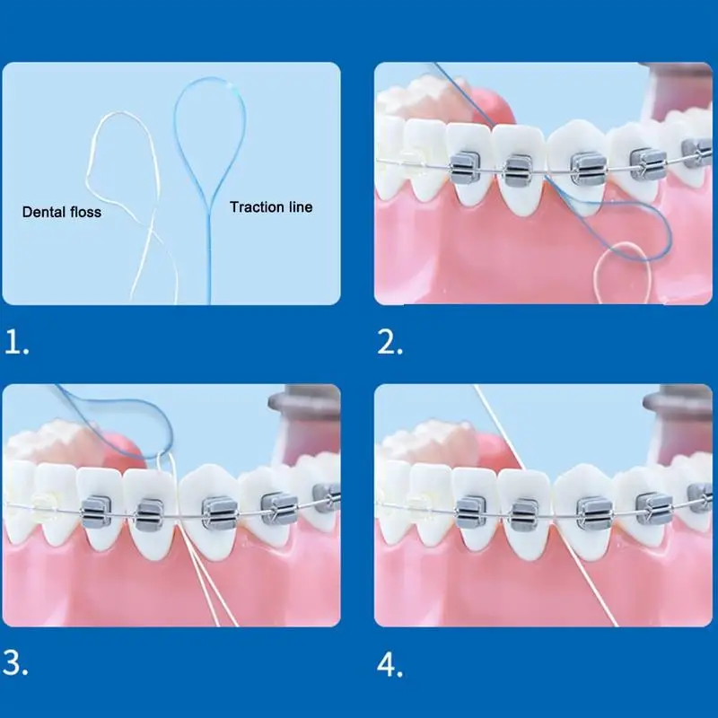 Цветной случайный стоматологический для ротовой полости нить Threader flossing игла игрушка износ свинцовые обручи для коррекции через свинцовые подтяжки стальная зубная тяга
