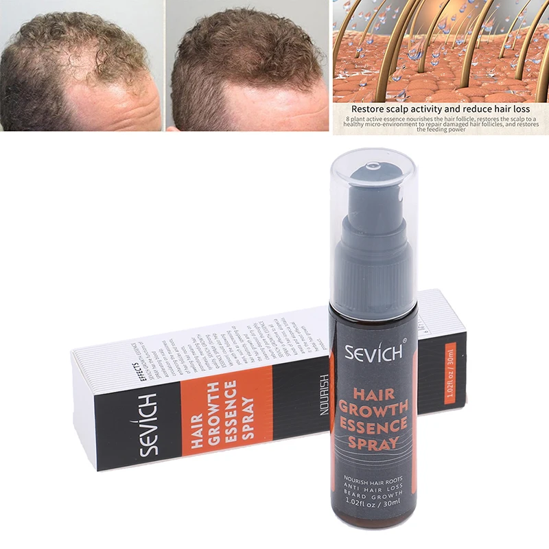 

Sevich 30ml Hebal Essence Fast Hair Growth Spray Hair Loss Treatment Help For Hair Growth Hair Care Useful Brand New