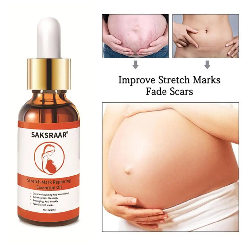 

Средство для удаления растяжек с эфирным маслом, 20 мл