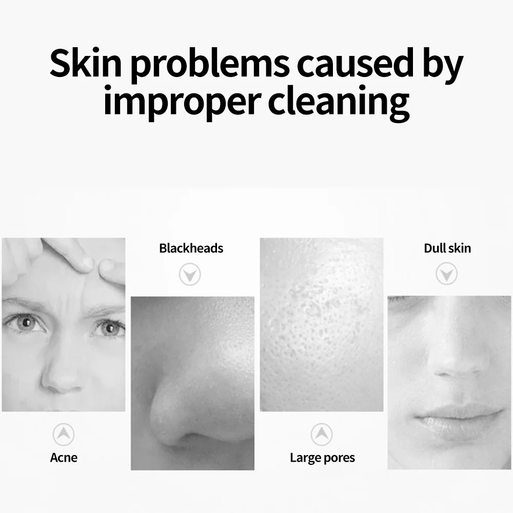 

Facial Blackhead Remover Electric Acne Cleaner Blackhead Black Vacuum face cleaner Tool Skin Care Machine Cleaner Beauty Tool