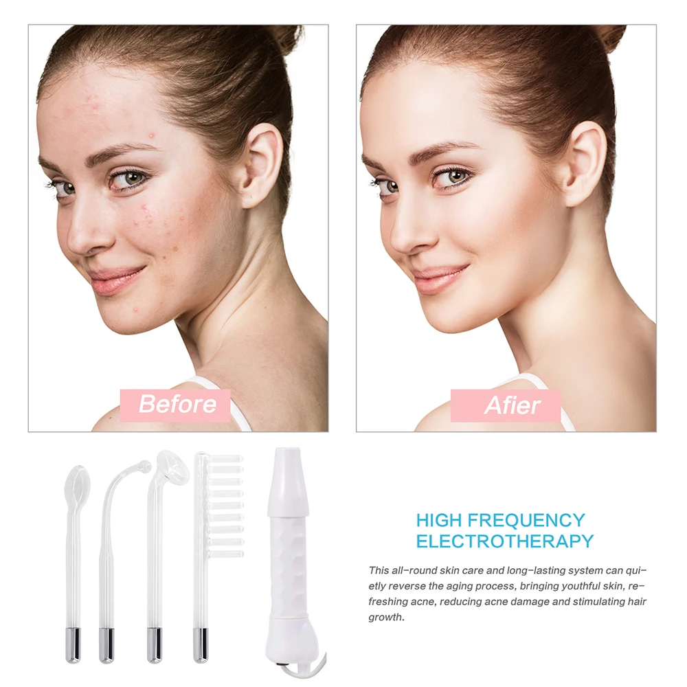 Portable Handheld High Frequency Skin Therapy Wand Machine Hair &amp Scalp Stimulator | Красота и здоровье