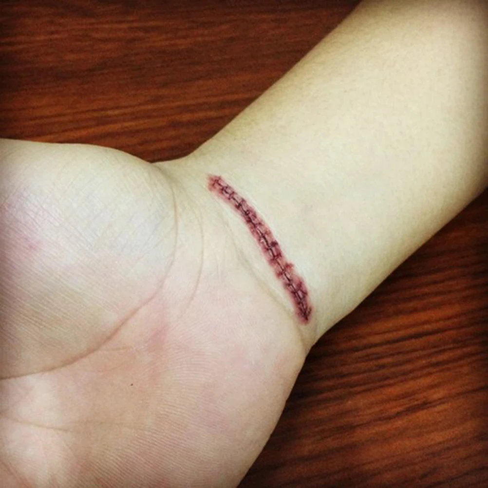 

Scars Tattoos With Fake Scab Bloody Makeup Halloween Decoration Wound Scary Blood Injury Sticker Halloween Decoration