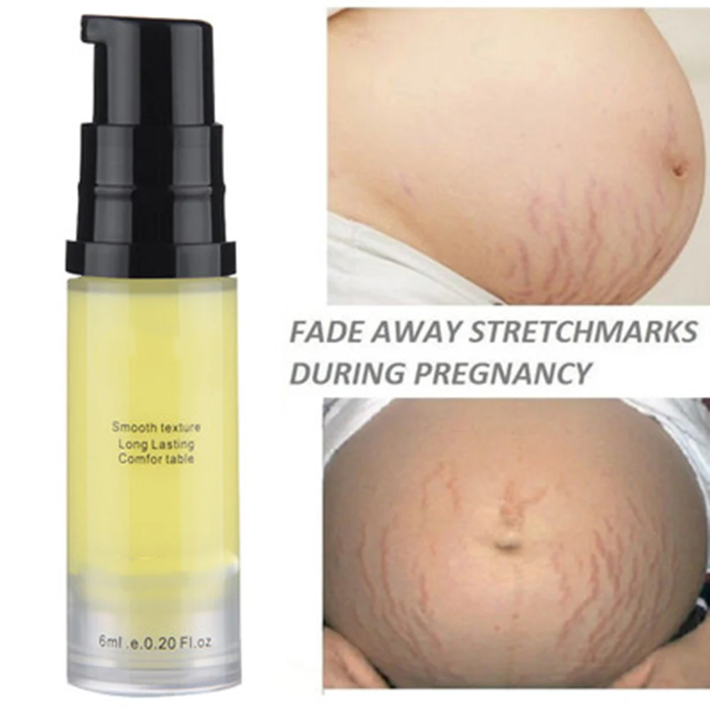 

Stretch Mark Removal Cream Postpartum Pregnancy Fade Reduce Stretch Marks Remover Repair Cream HJL2019