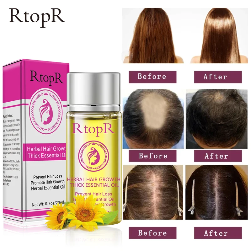 Быстрое мощное средство с эссенцией для рост волос эфирное масло жидкое лечение