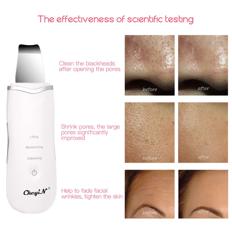 

CkeyiN EMS Electroporation RF Radio Frequency LED Photon Skin Scrubber Nano Mist Sprayer Facial Vacuum Blackhead Remover Lifting