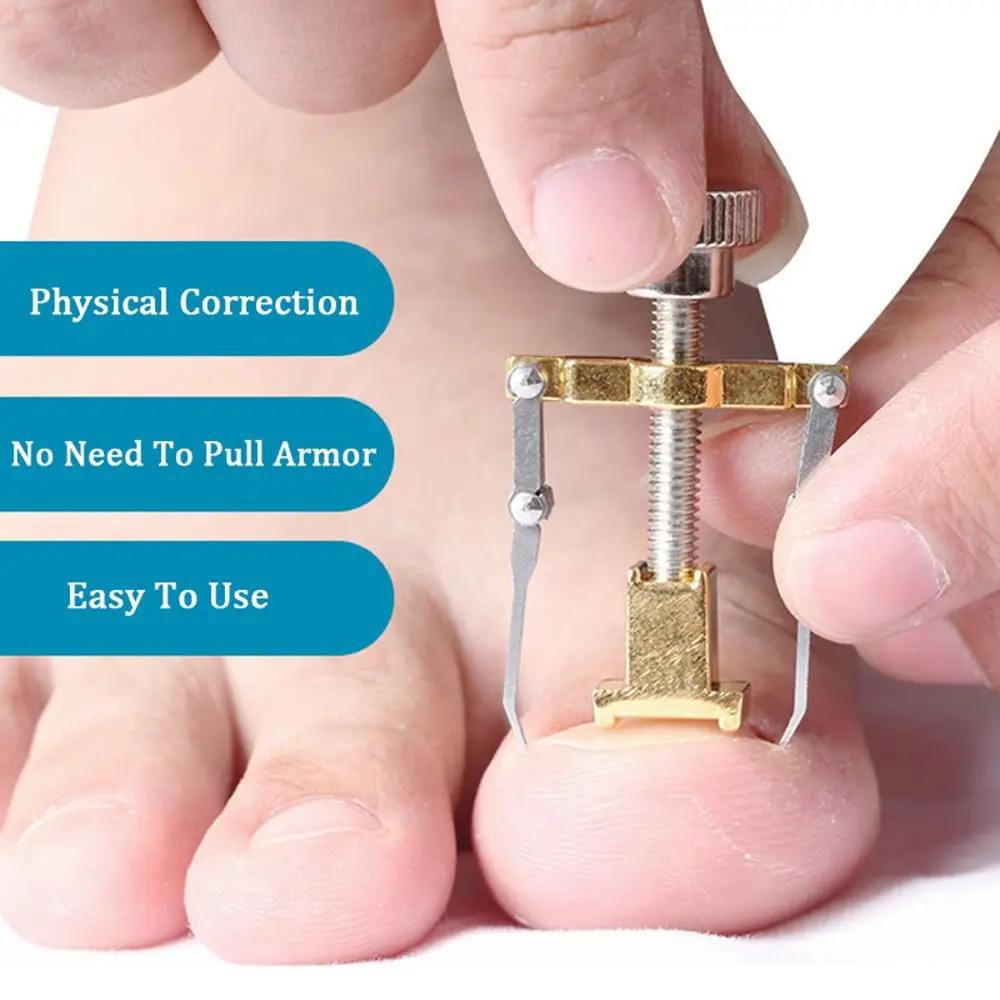 

Ingrown Toenail Correction Pedicure Tools Paronychia Foot Care Nail Recover Professional Pedicure Tools Set