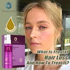 Спрей для быстрого роста волос HAIRCUBE, лечение против выпадения волос, эфирное масло для мужчин, женщин, мужчин, питательный тоник для корней волос