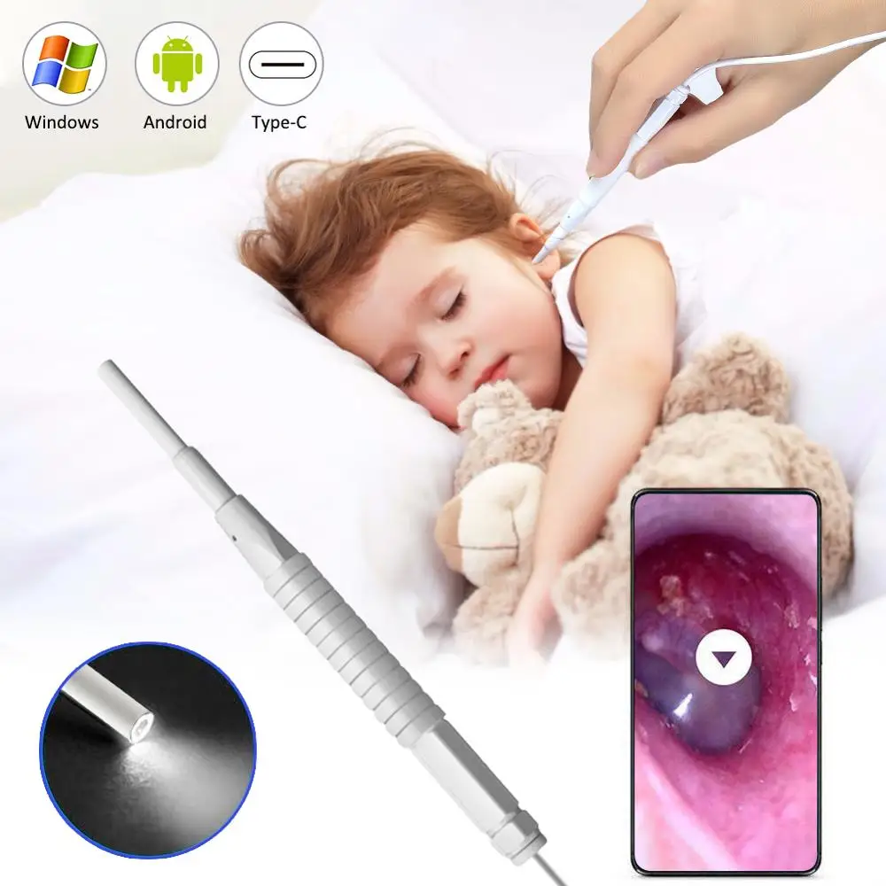 Модернизированная usb-камера Otoscope с цифровым отоскоп ушной камерой для очистки