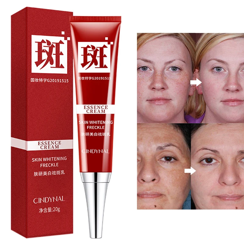 

20g Freckle Whitening Cream Skin Care Brighten Whitening Cream Remove Dark Spots Melanin Melasma Brighten Skin Anti Aging