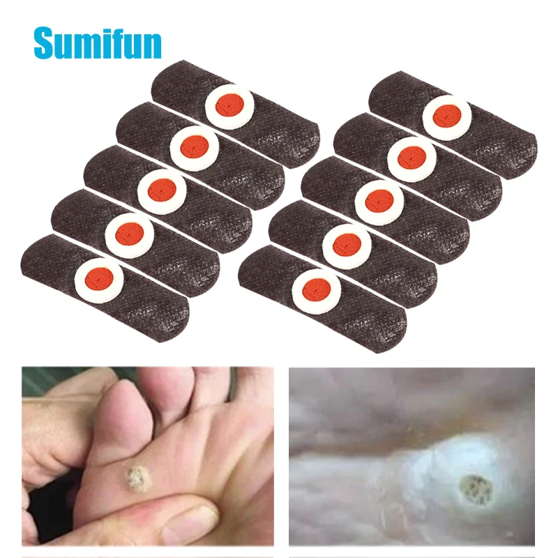 

10/20/30Pcs Foot Corn Removal Patch Feet Care Remove Moles Warts Calluses Sticker Soften Skin Cutin Pain Relief Medical Plaster