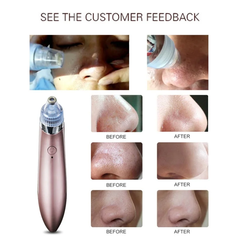 

Blackhead Cleaner Home Electric Handheld Clean Exfoliating Makeup Beauty Tool
