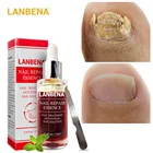 Сыворотка для восстановления ногтей от грибков LANBENA, уход за ногами, удаление грибка ногтей, противоинфекционный гель для лечения паронихии и онихомикоза