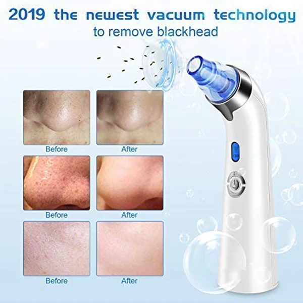 

Blackhead Remover Pore Vacuum - Facial Pore Cleanser Electric Acne Comedone Extractor Kit Usb Rechargeable Blackhead Suction Too